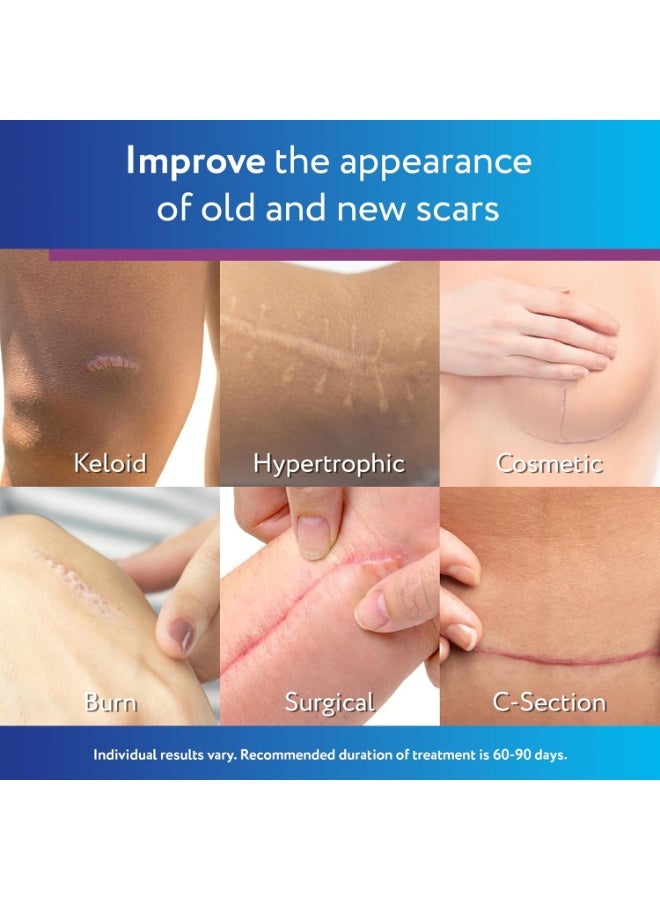 سكار أواي جل ندبات سيليكون طبي 100% من سكاراوي للوجه والجسم والندوب الجراحية والحروق والندبات التضخمية والكيليات وعلاج ندبات حب الشباب، 0.71 أوقية (20 جرام) - Image 3